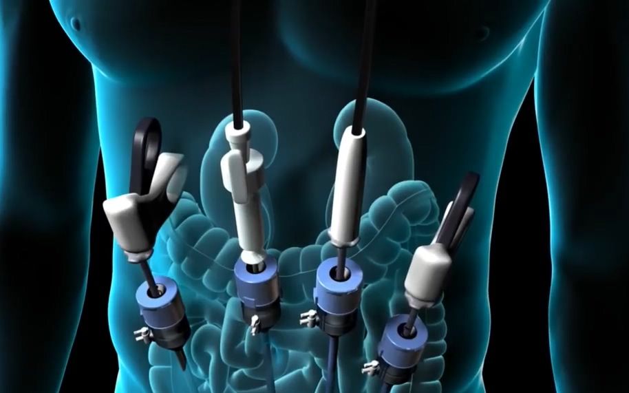 “IM电竞”33岁C罗食谱曝光 一日六餐+多吃鱼类是成功秘诀(图3) IM电竞官网